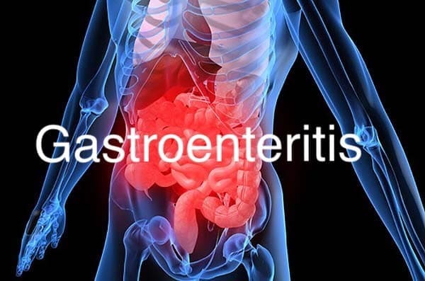 La gastroenteritis y el seguro médico e España
