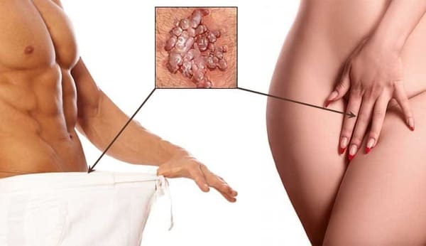 Papiloma Humano y el Seguro Médico en España