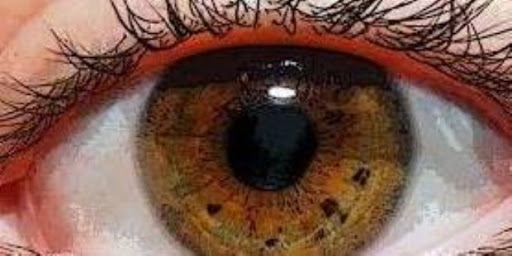 Retinosis Pigmentaria en España