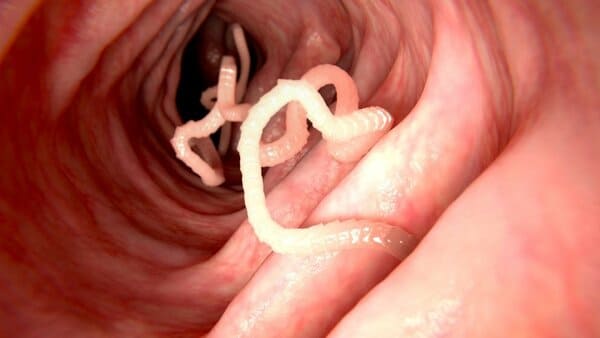 Enfermedad por Parasitosis intestinal y el seguro médico en España