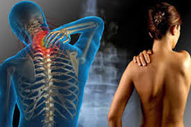 Afecciones  cervicales  y el seguro medico en España