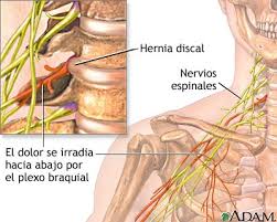 Causas de las Afecciones Cervicales 
