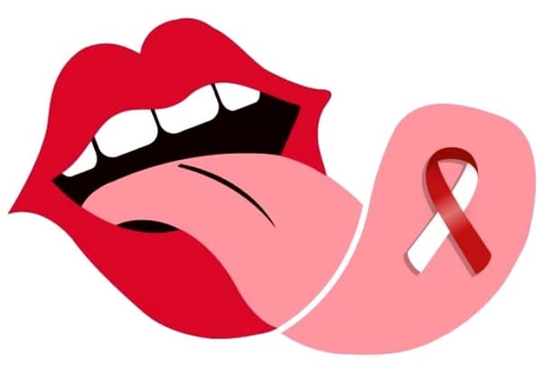El cáncer oral en España