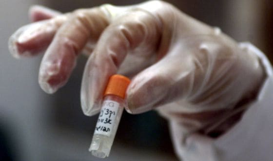 Las Consecuencias de la Viruela para la Salud en España