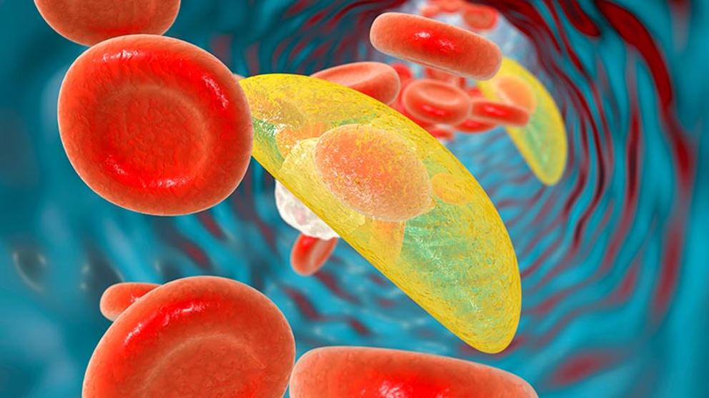 La Toxoplasmosis y el Seguro Medico en España