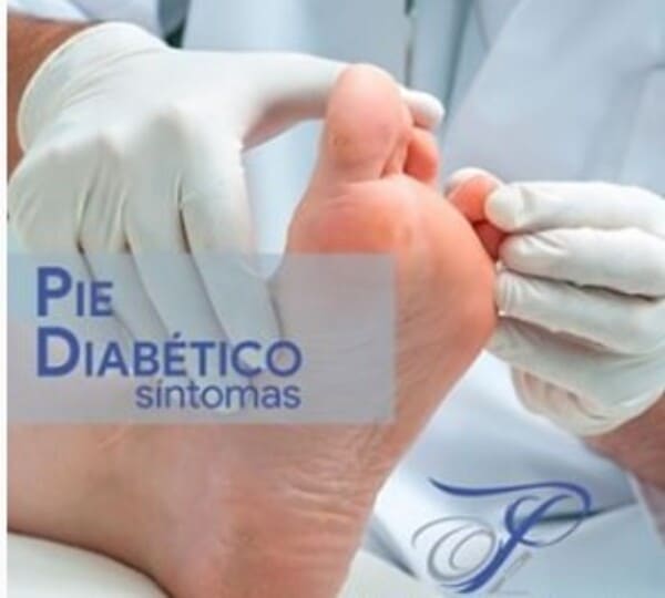 El pie diabético en España ¿Que se debe hacer?