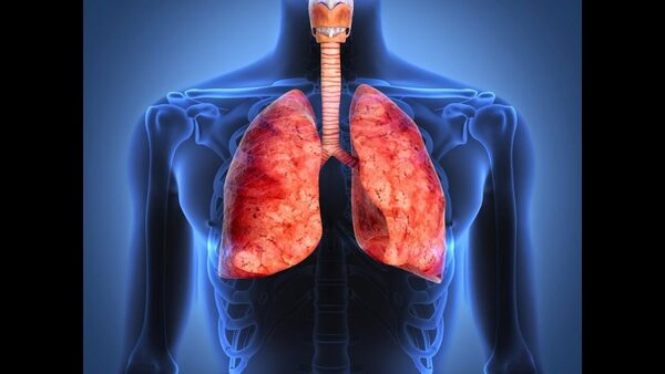 Fibrosis Pulmonar y el Seguro Medico en España