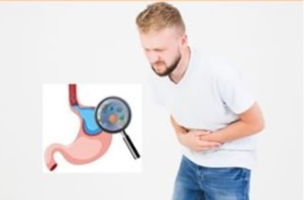 Helicobacter Pylori Bacteria Gástrica y el Seguro Medico en España
