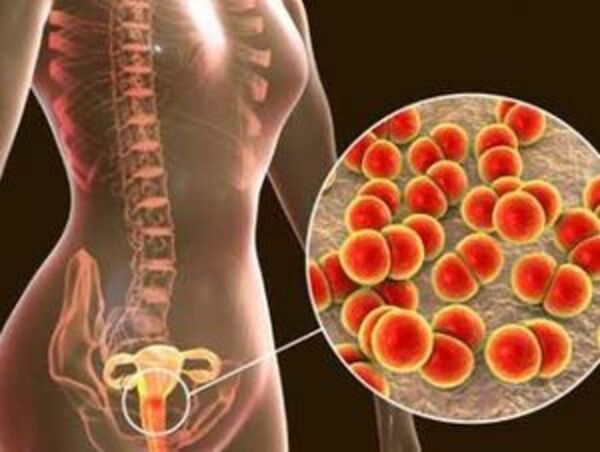 La Gonorrea y el seguro Medico en España