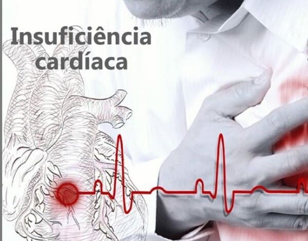 Las Arritmias Cardíacas y el Seguro Médico en España