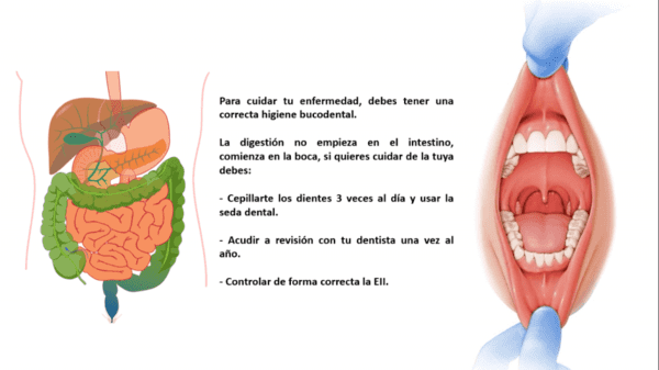 Lesiones Bucales Relacionadas con las Enfermedades Digestivas en España