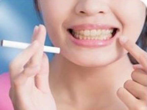 ¿Puedo contratar el seguro de salud si soy fumador?