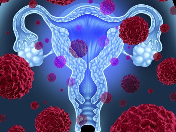 Trastorno de Menstruación en España