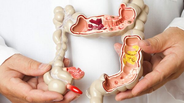 Coloproctología Hospital Vithas Vitoria Gasteiz Álava