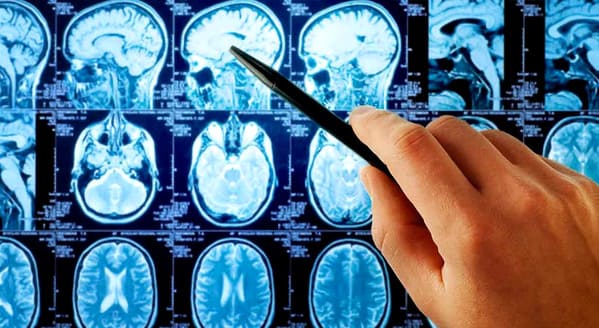 Neurología Hospital Vithas Vitoria Gasteiz Álava