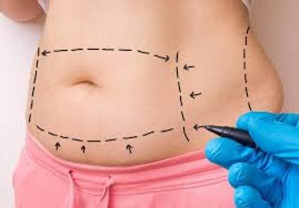 Cirugía de Abdomen Clínica Sarabia Álava
