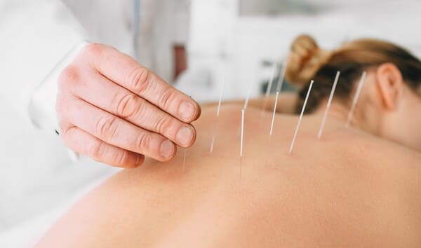 Acupuntura Clínica de Fisioterapia y Osteopatía Fisiona Álava