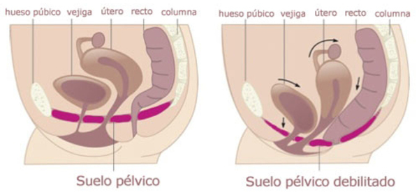 Suelo Pélvico Clínica Akari Salud y Bienestar Álava
