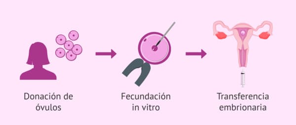 Ovodonación Instituto iGin Vitoria Álava