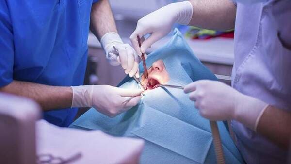 Cirugía Bucal en la Clínica Dental Álava