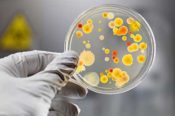 Microbiología del Hospital de Leza Álava