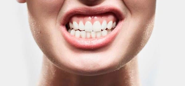 Bruxismo en la Clínica Dental Álava