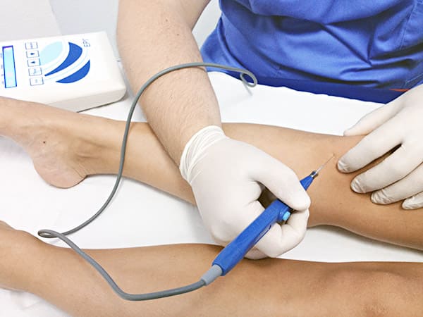 Electrólisis Percutánea Intratisular (EPI) Clínica Angulema Álava