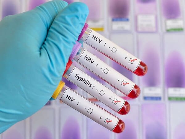 Enfermedades de Transmisión Sexual Clínica ASKABIDE Gasteiz Álava