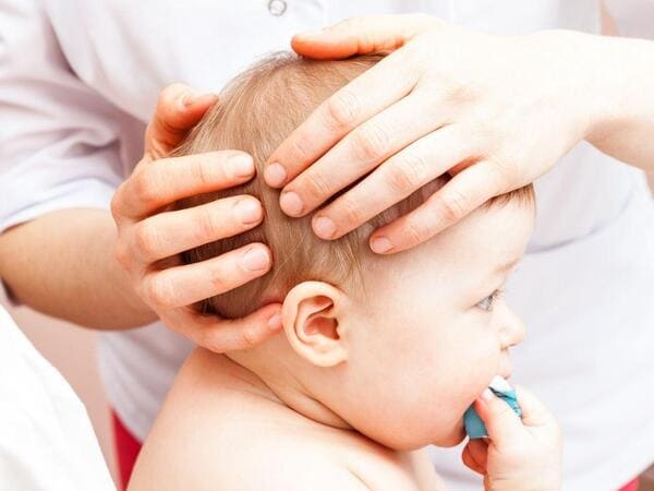 Osteopatía Pediátrica Plagiocefalia Clínica Angulema Álava