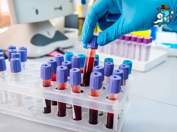 Hematología y hemoterapia Mutualía Hospital de Alta Resolución Álava