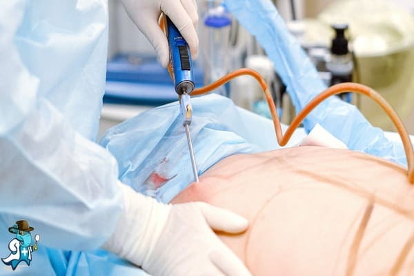 ¿Cuáles son las Exclusiones del Seguro Médico en España?