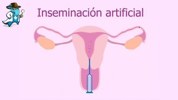 Área de Inseminación artificial Clínica IVF-Life Alicante
