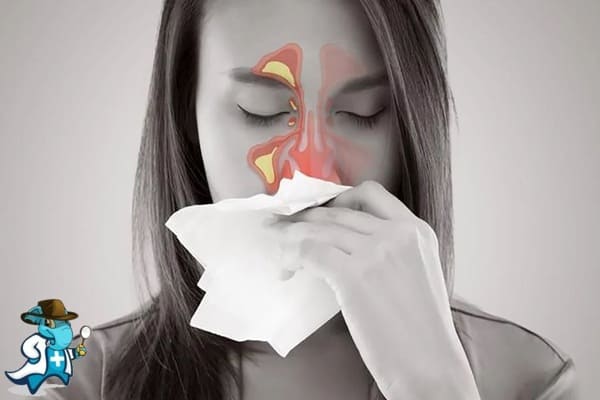 ¿Aumenta el Precio del Seguro Médico para una Persona con Sinusitis en España?