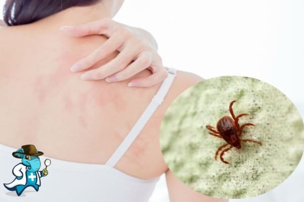 ¿Cubre el Seguro Médico la Alergia a los Ácaros en España?