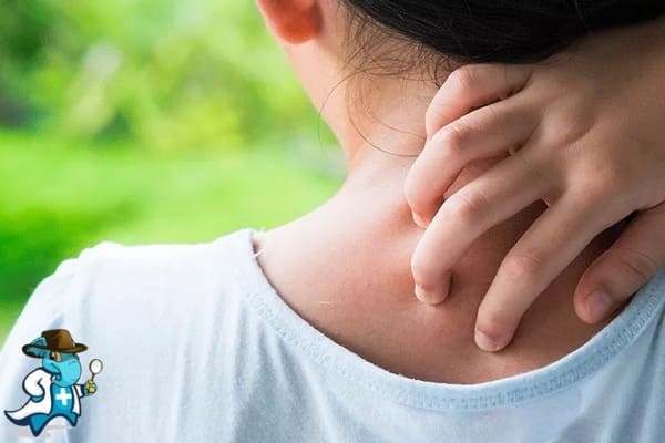 ¿Cubre el Seguro Médico la Esquistosomiasis en España?