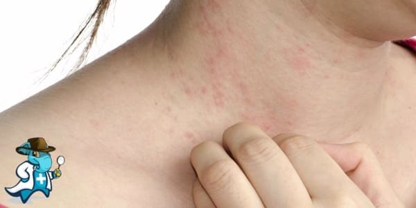 ¿Qué Exclusiones Tendría un Seguro Médico para una Persona con una Alergia a las Fragancias en España?