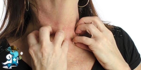 ¿Qué Exclusiones Tendría un Seguro Médico para una Persona con una Alergia a los Ácaros en España?
