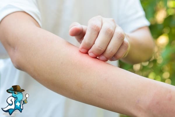 ¿Qué Exclusiones Tendría un Seguro Médico para una Persona con una Alergia al Sol en España?