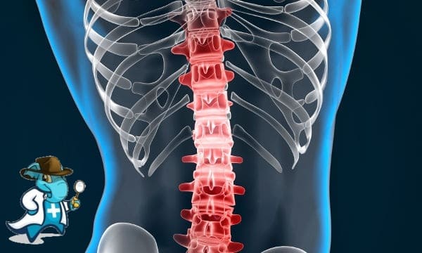 ¿Cubre el Seguro Médico la Espondilitis en España?