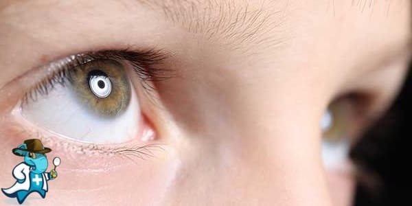 ¿Puedo Contratar un Seguro Médico si Tengo Cataratas en España?