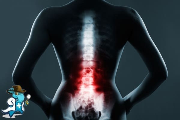 ¿Puedo Contratar un Seguro Médico si Tengo Mieloma Múltiple en España?