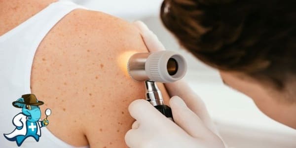 ¿Puedo Ocultar que Tengo Cáncer de Piel para Contratar el Seguro Médico en España?
