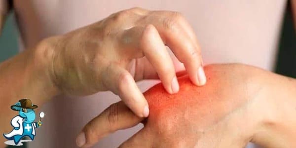 ¿Puedo Ocultar que Tengo Lepra para Contratar el Seguro Médico en España?