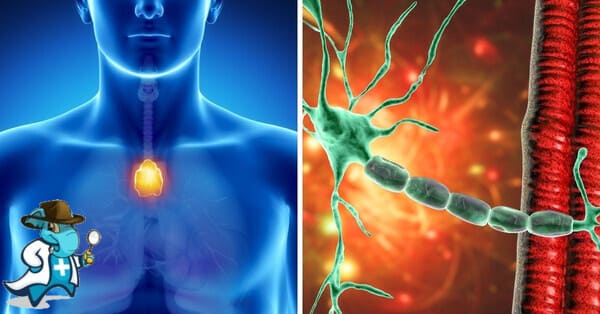 ¿Puedo Ocultar que Tengo Miastenia Gravias Para Contratar el Seguro Médico en España?