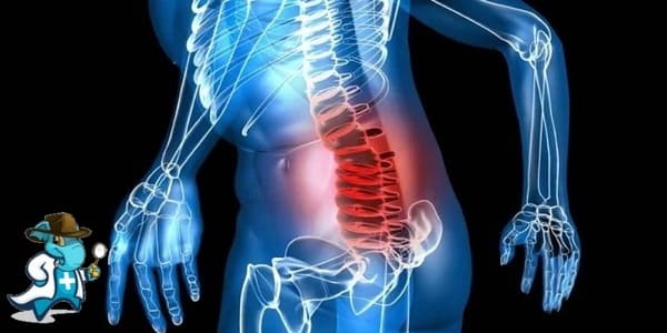 ¿Puedo Ocultar que Tengo Mieloma Múltiple para Contratar el Seguro Médico en España?