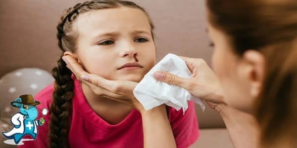 ¿Puedo Ocultar que he Tenido una Hemorragia Nasal para Contratar el Seguro Médico en España?