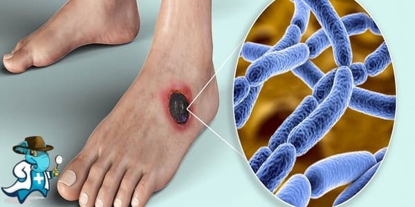 Infectología Mutualía Hospital de Alta Resolución Álava