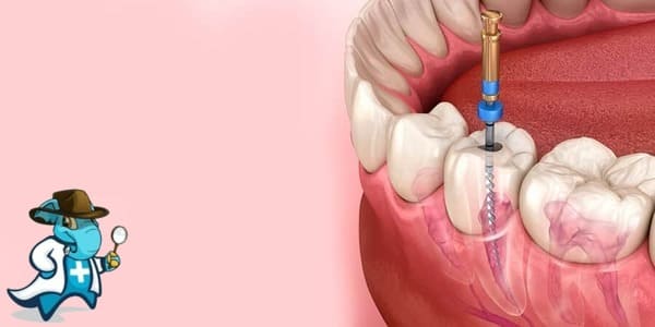 Endodoncia Centro Médico Enova Toledo