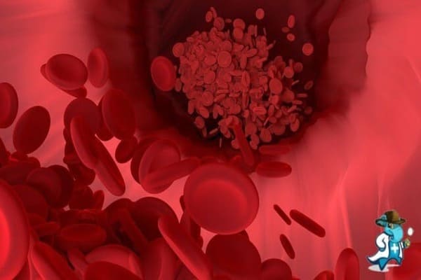 ¿Puedo Contratar un Seguro Médico si Tengo Anemia de la Insuficiencia Renal en España?
