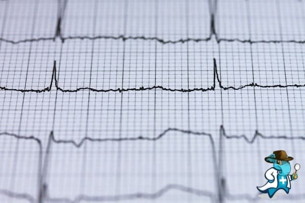 ¿Puedo Contratar un Seguro Médico si Tengo Palpitaciones Cardiacas en España?